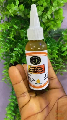 Special Dandruff Treatment Oil – Scalp Relief Formula